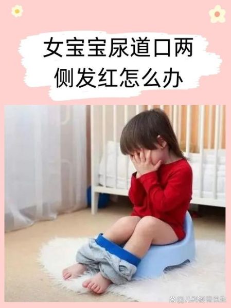 宝宝小鸡头尿道口发红怎么办_婴儿尿道口红肿原因