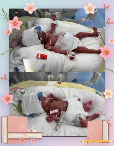 32周早产宝宝多久能出院_32周早产宝宝要住保温箱多久