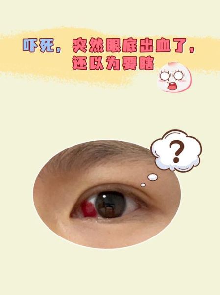 梦到眼睛是什么意思_梦见眼睛流血代表什么