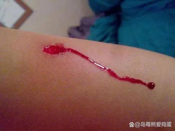 梦到放血是什么意思_梦见自己流血不止怎么办