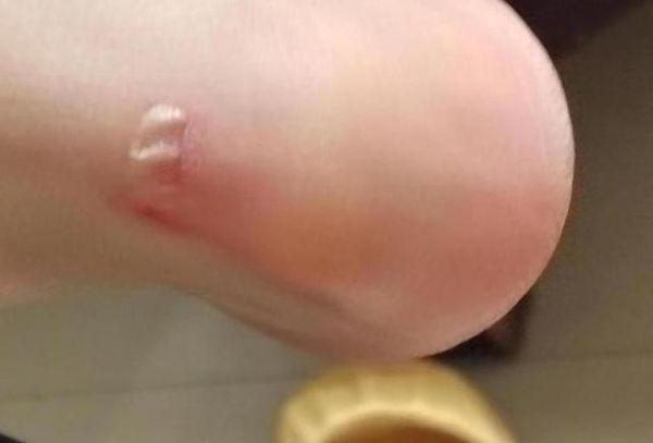 梦到拖鞋坏了_代表什么预兆