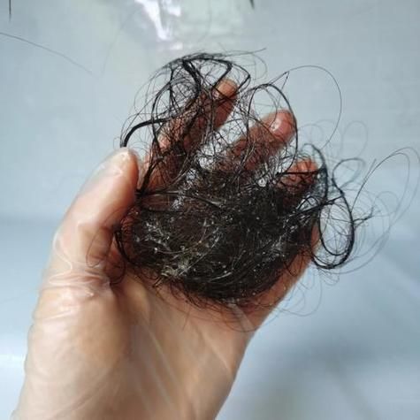 梦见掉头发_意味着什么