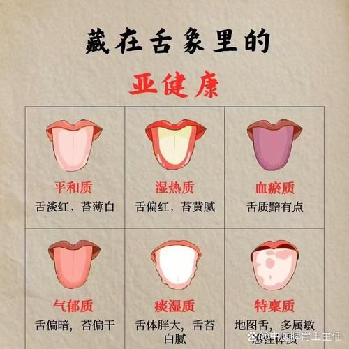 舌头各种症状图片大全_舌象异常对照表