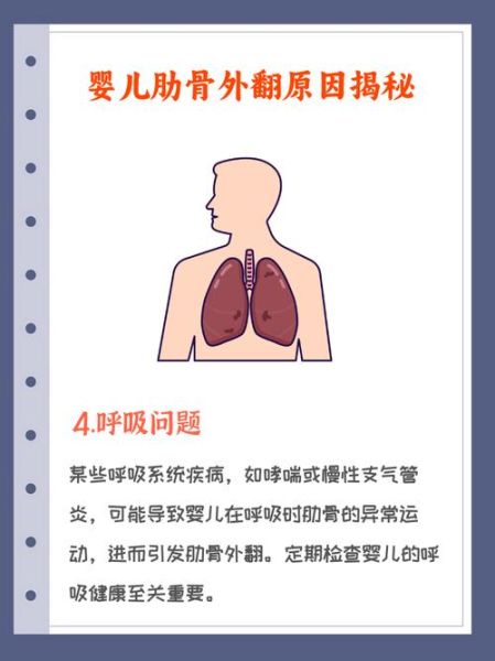 宝宝肋骨外翻怎么办_如何判断肋骨外翻