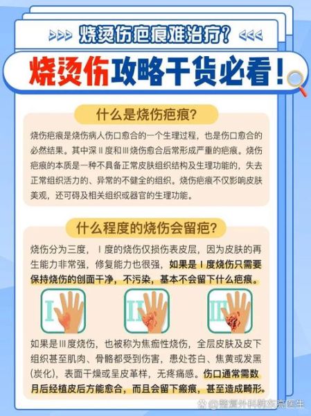 梦到被火烧伤是什么意思_梦到被火烧伤预示什么