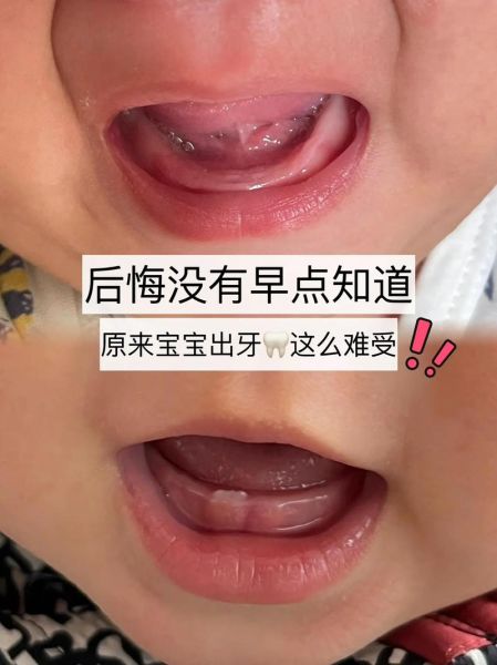 7个月宝宝长牙症状_宝宝长牙哭闹怎么办