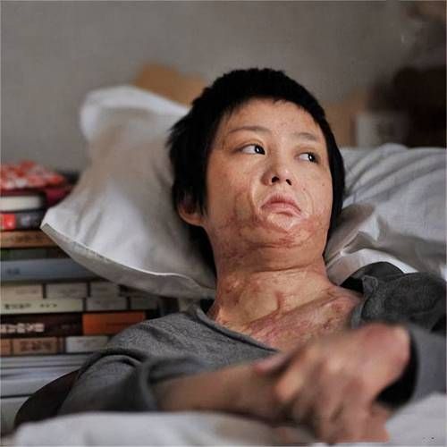 梦到毁容是什么意思_梦见自己毁容了怎么办