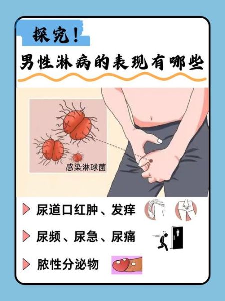 男性疾病图片大全_常见症状有哪些