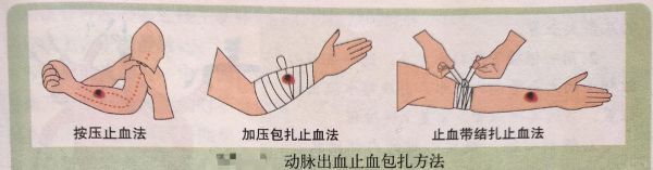 流血图片大全_如何快速止血