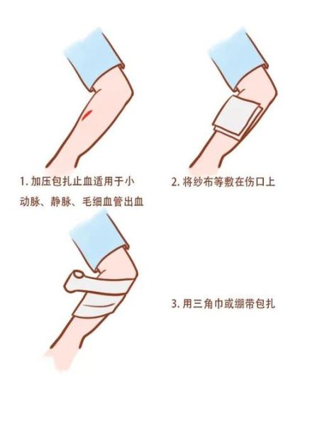 流血图片大全_如何快速止血