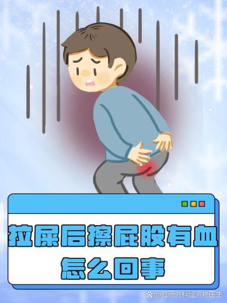 梦到擦屁股是什么意思_梦见擦屁股很脏怎么解