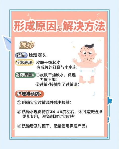 六个月宝宝湿疹怎么办_婴儿湿疹护理方法