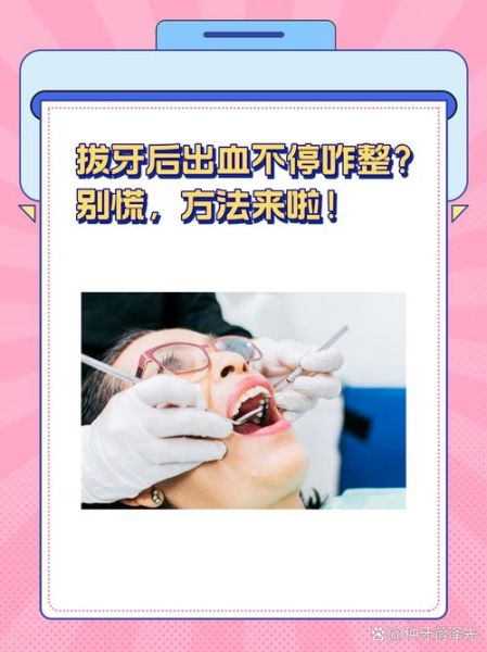 梦到拔牙是什么意思_梦到拔牙出血怎么办