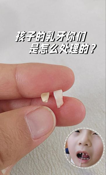 宝宝乳牙掉了怎么处理_乳牙掉了要补吗
