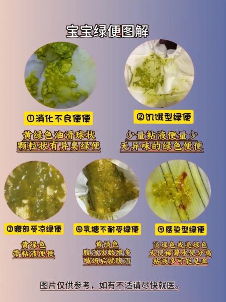 宝宝拉灰白色大便怎么回事_灰白色大便正常吗