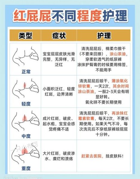 宝宝屁股红怎么办_新生儿红屁股护理方法