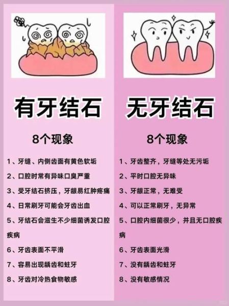 牙齿图片大全图_如何辨别龋齿与牙结石