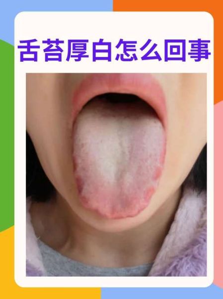 宝宝舌苔厚白怎么调理_婴儿舌苔厚白吃什么好
