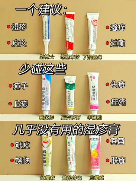 宝宝手上长湿疹怎么办_宝宝湿疹用什么药膏好