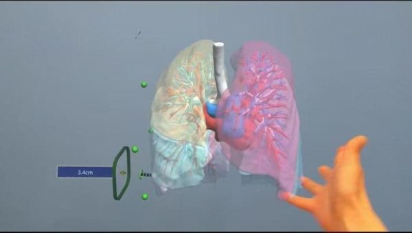 梦到动手术是什么意思_梦到做手术预示什么