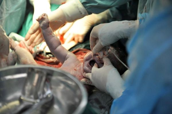 生孩子图片大全_孕妇分娩真实过程图解