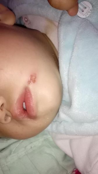 宝宝嘴巴边上长水泡怎么回事_怎么处理