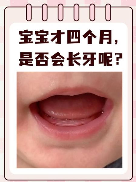 3个多月宝宝长牙正常吗_婴儿最早几个月长牙算正常