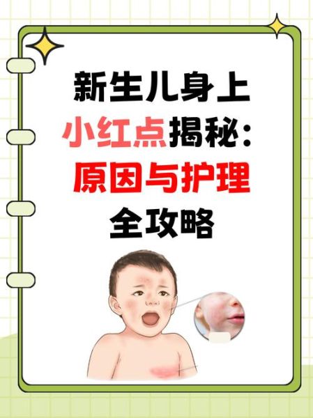 宝宝身上红斑怎么办_新生儿红斑多久能退