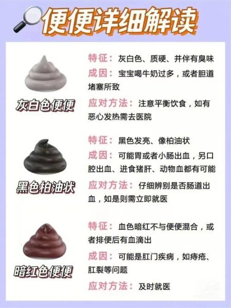 宝宝大便发白是什么原因_宝宝大便发白怎么办