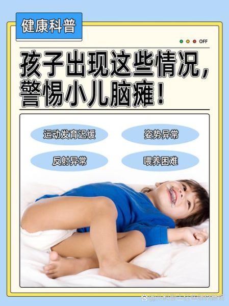 宝宝肌张力低是脑瘫吗_肌张力低与脑瘫区别