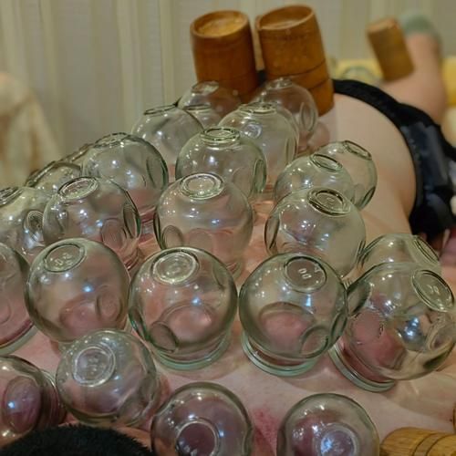 拔火罐图片大全_拔火罐多久一次合适