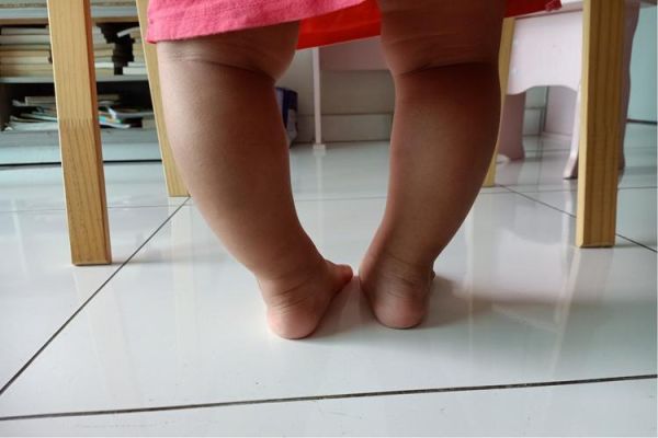 宝宝小腿弯曲正常吗_需要矫正吗