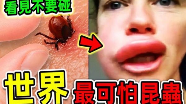 恐怖虫子图片大全_哪些虫子最吓人