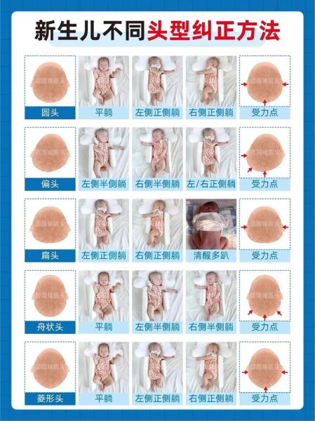 宝宝头型怎么睡好看_婴儿头型几个月定型