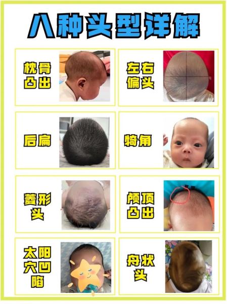 宝宝头型怎么睡好看_婴儿头型几个月定型