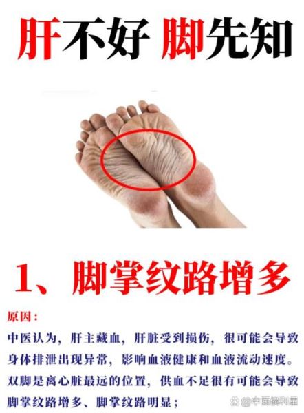 脚底板图片大全_脚底纹路图解