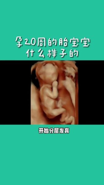 20周宝宝图片怎么看男女_20周宝宝发育指标正常吗