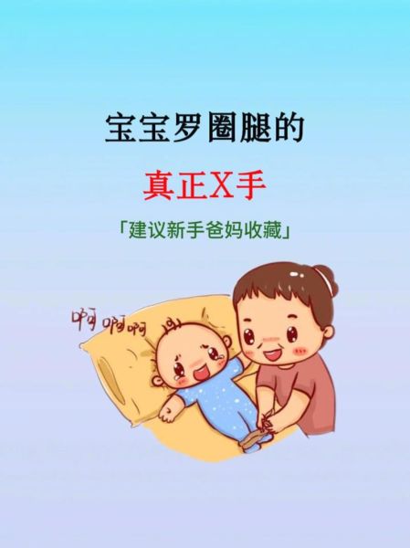 宝宝罗圈腿图片_如何判断是否O型腿