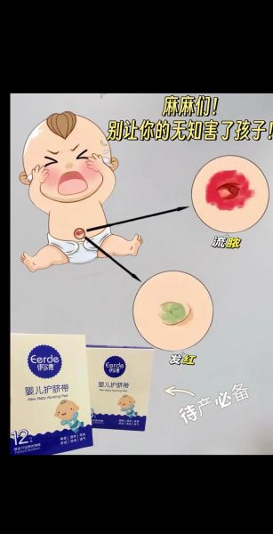 宝宝肚脐多久脱落_新生儿脐带护理多久脱落