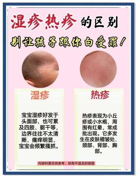 宝宝湿疹过敏源有哪些_如何快速排查