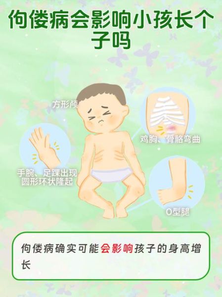 宝宝佝偻病的早期症状图片_如何辨别佝偻病初期表现