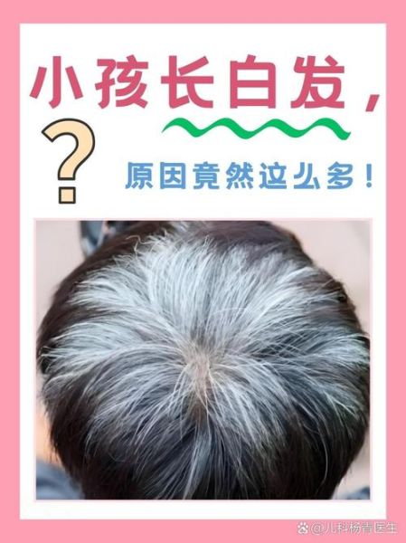 宝宝有白头发是缺什么_宝宝长白头发缺什么营养